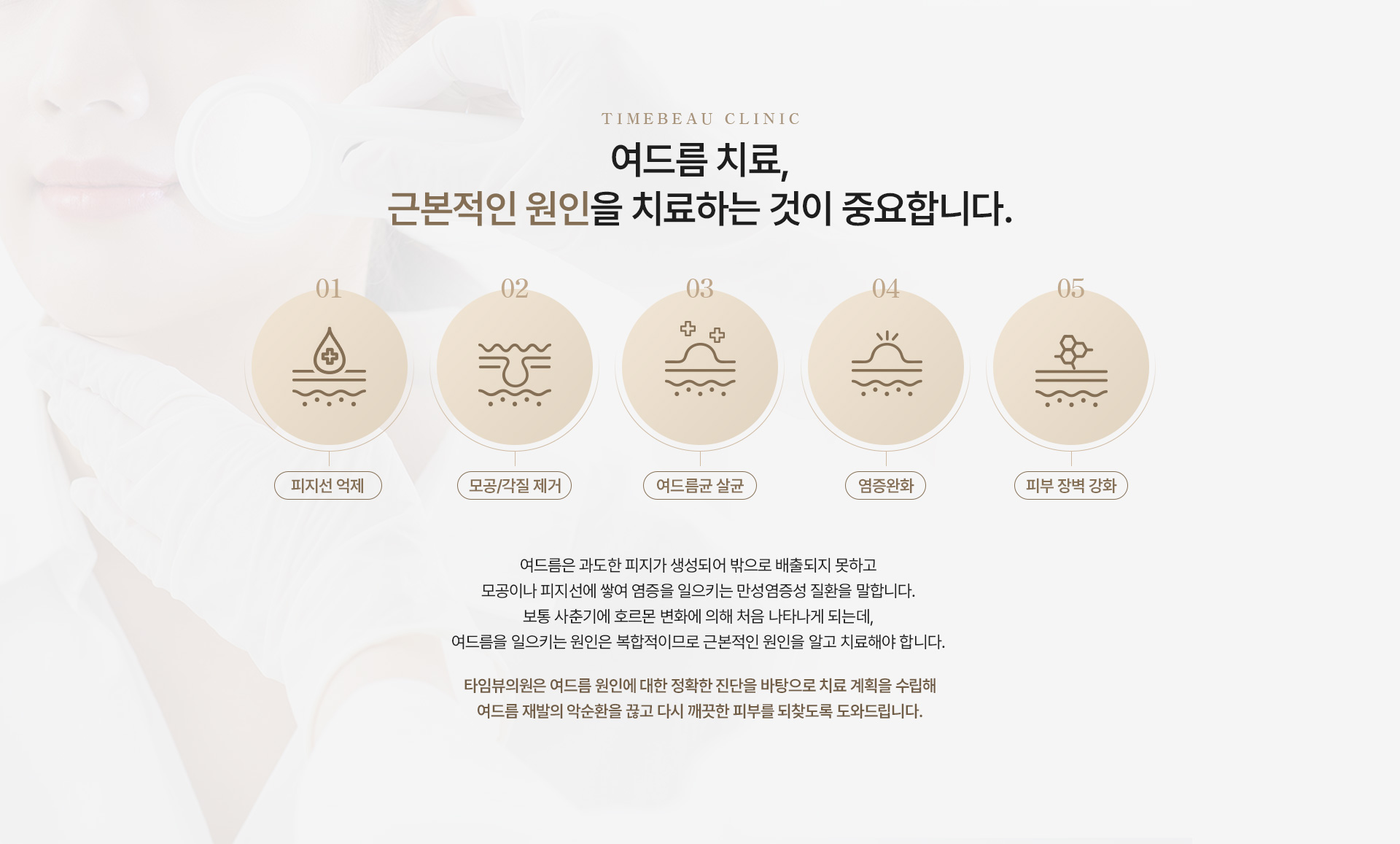 여드름 진단