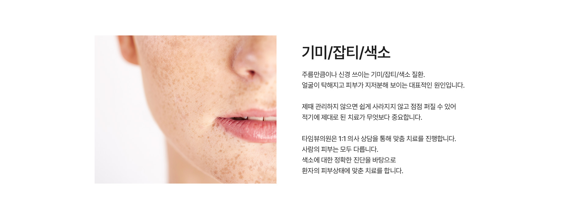 기미/잡티/색소 정의