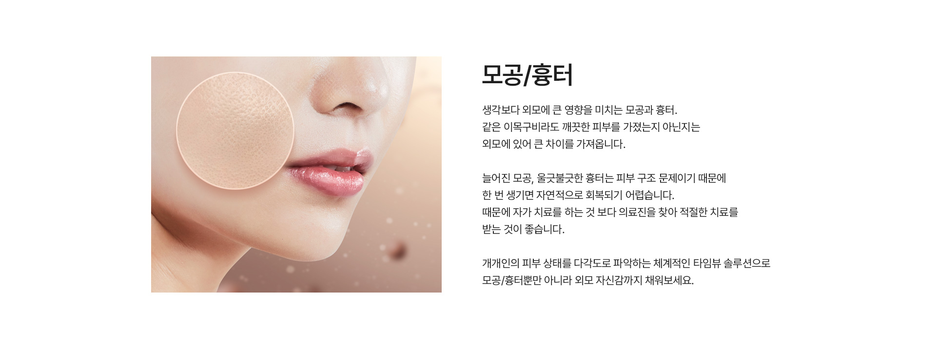 모공/흉터 정의