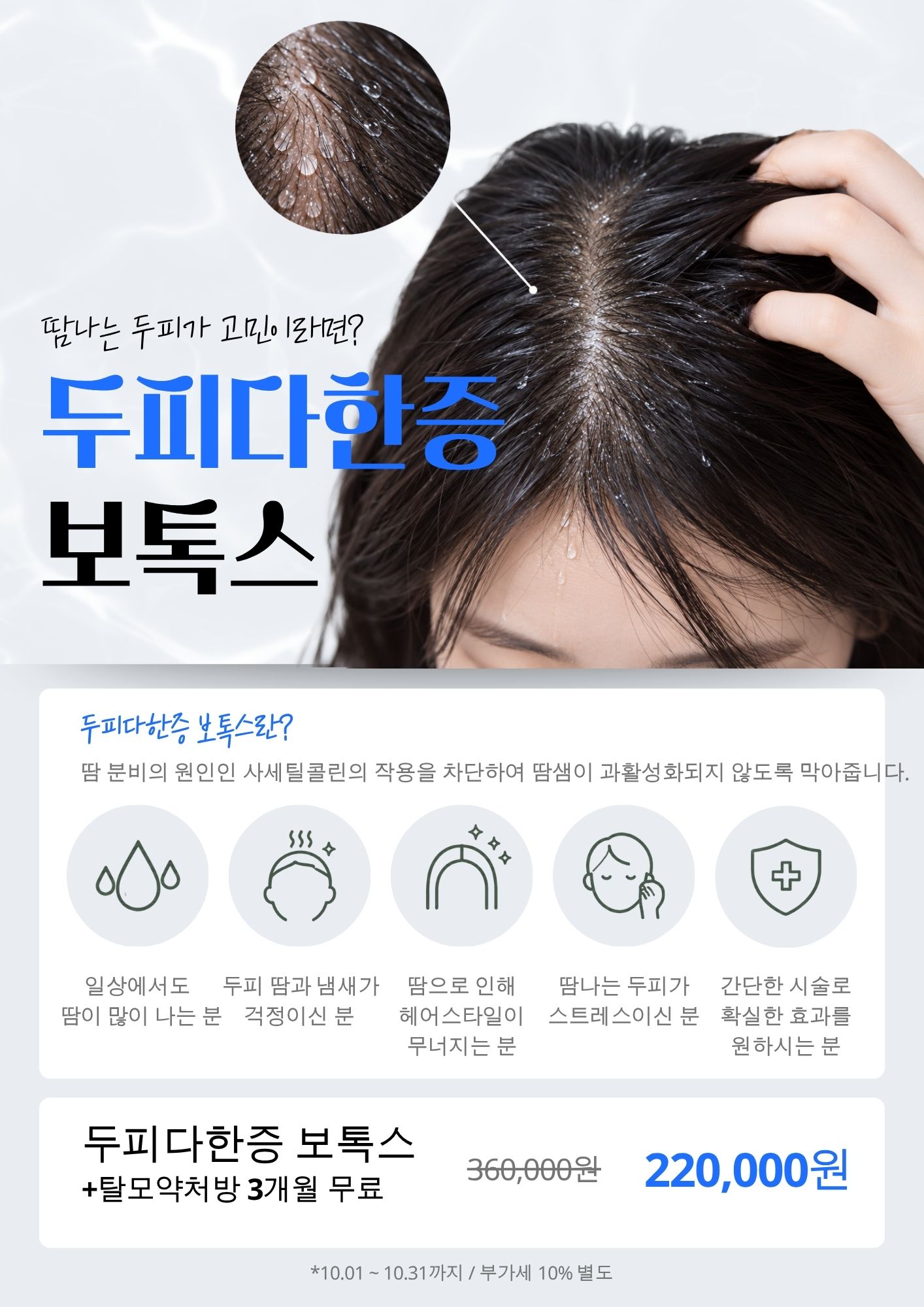 두피다한증 보톡스!